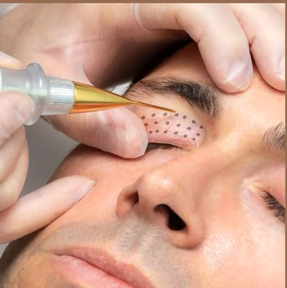 Microcurrent Facial Toning Device